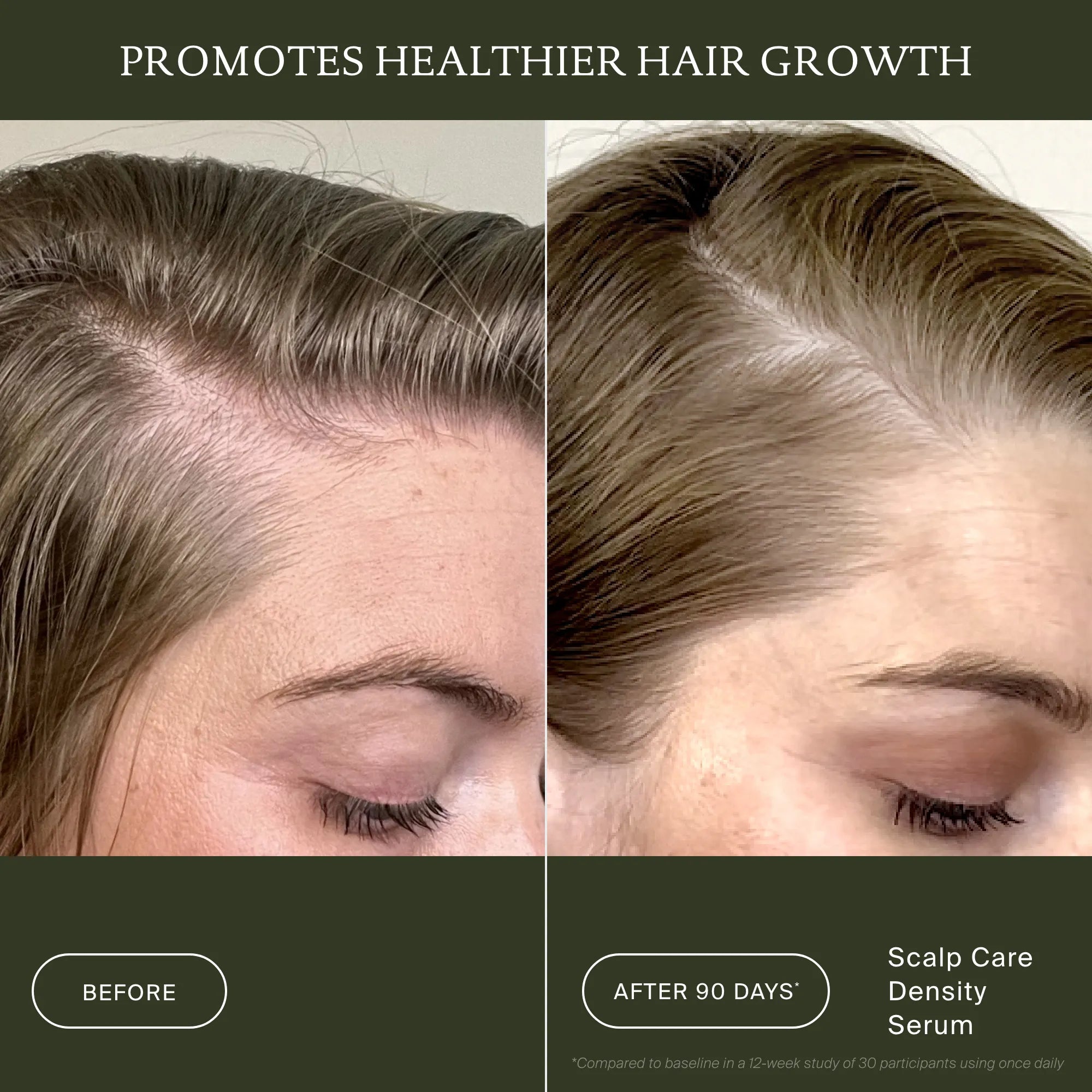 Scalp Care Density Serum - Image 4