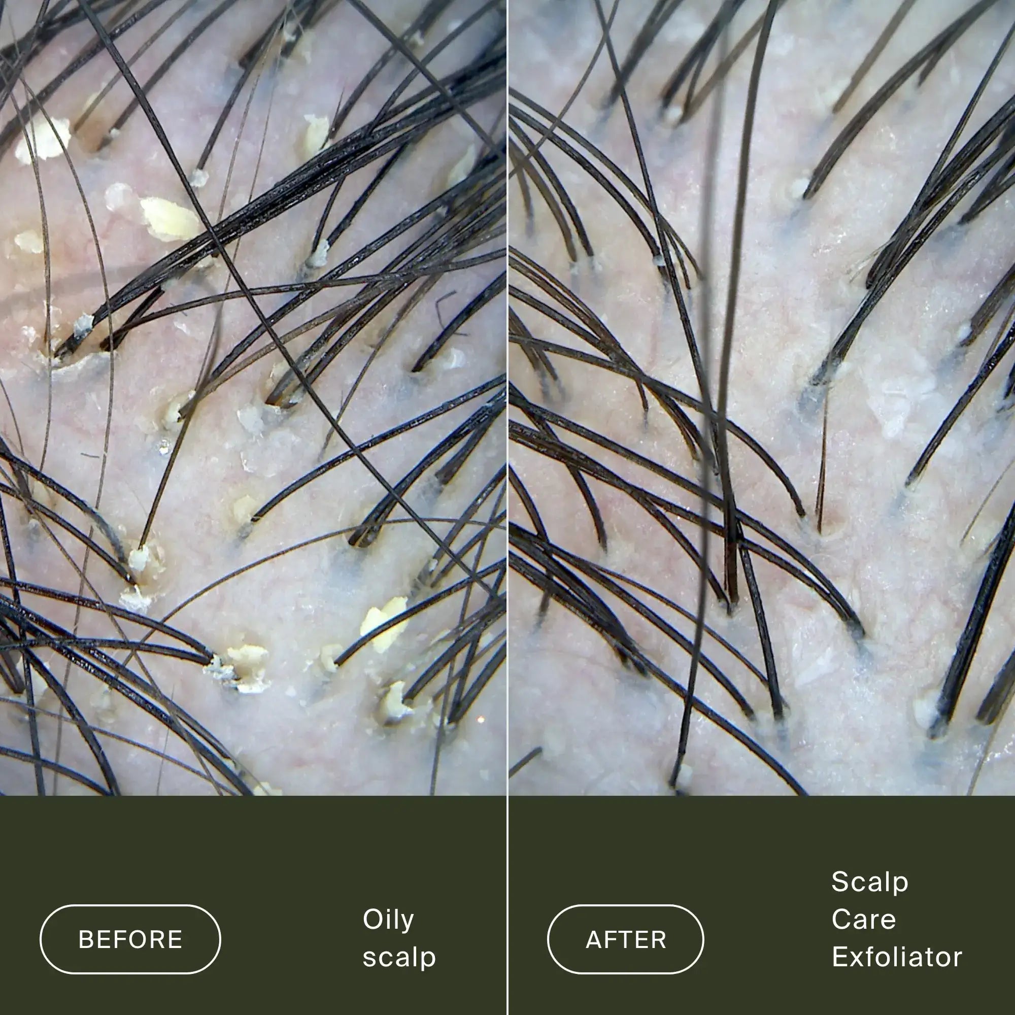Scalp Care Exfoliator - Image 4